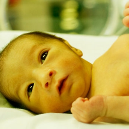 Newborn with yellow-tinged skin from jaundice
