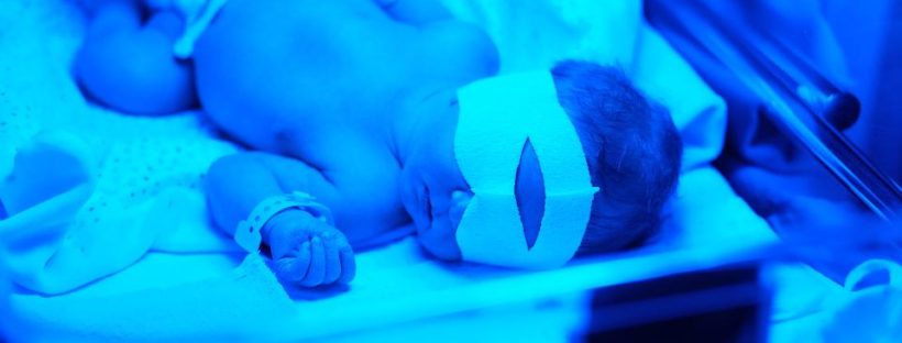 Newborn receiving phototherapy treatment.