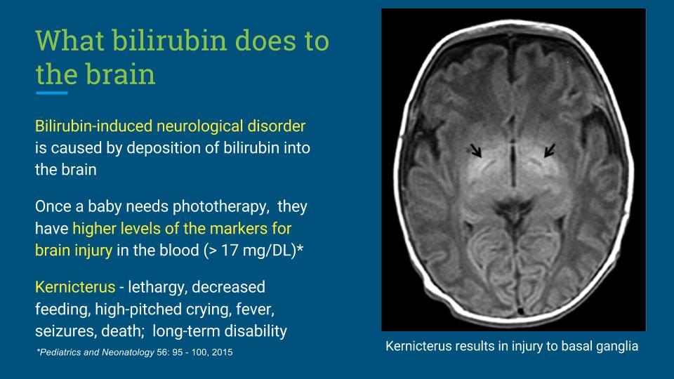 #1- Why Fed is Best for Newborn Jaundice.pptx (6)