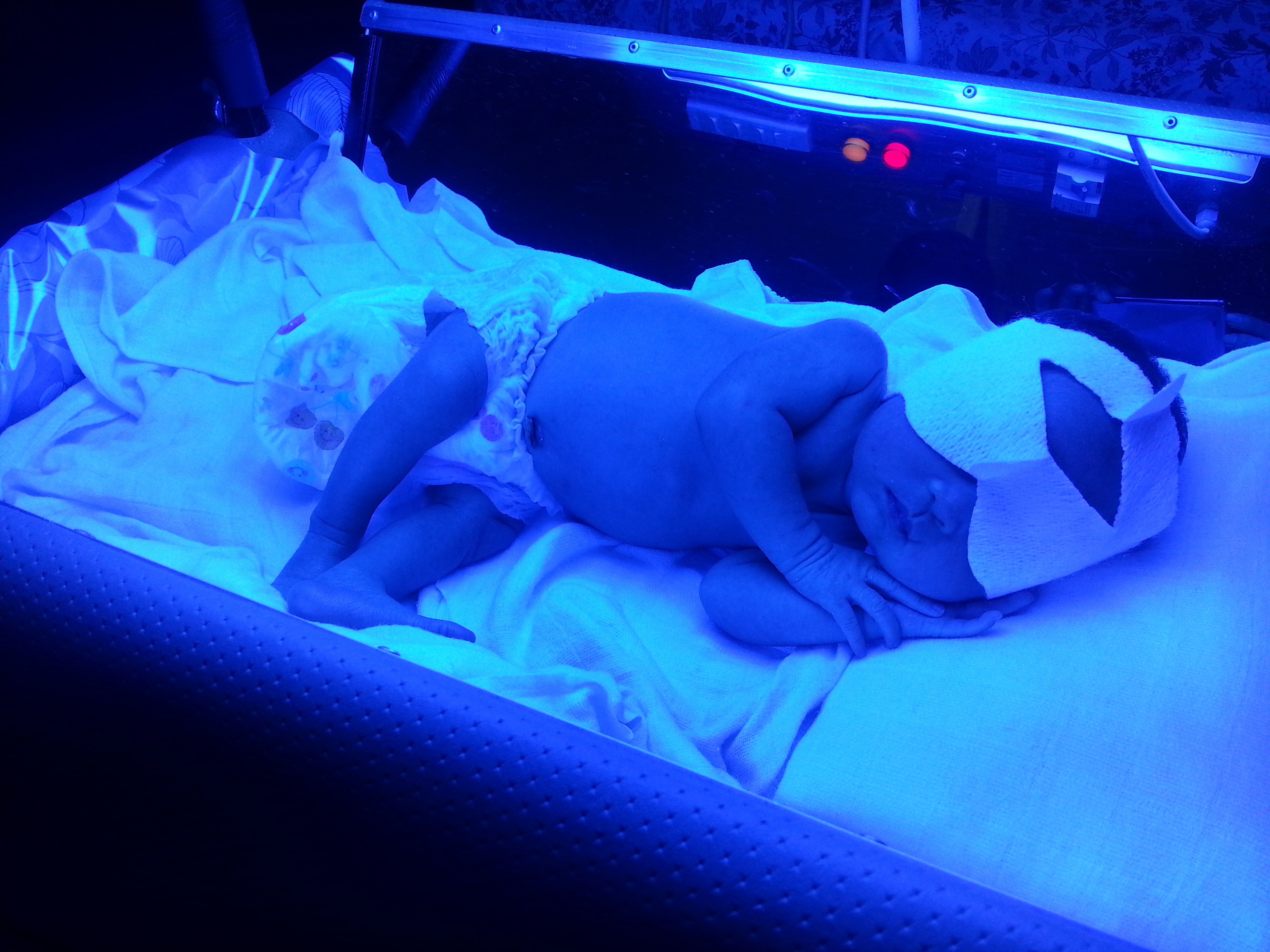 УФ лампа для новорожденных с желтушкой