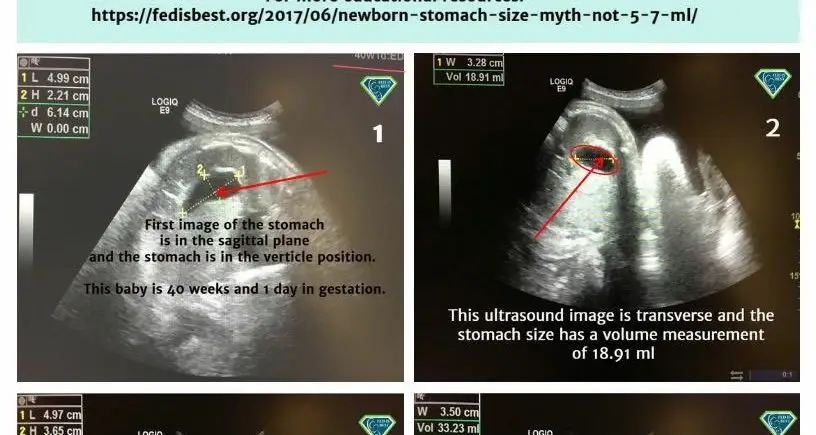 Fetal stomach ultrasound at 40 weeks.