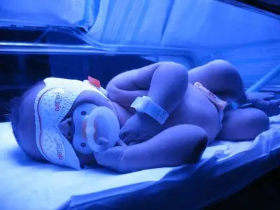 Newborn baby receiving phototherapy treatment.