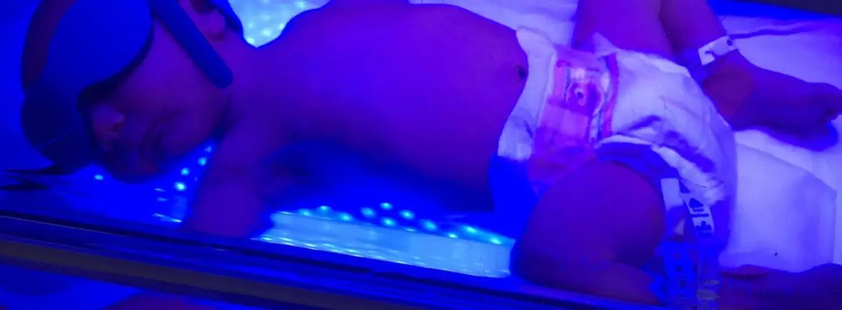 Newborn receiving phototherapy treatment.