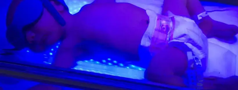 Newborn receiving phototherapy treatment.