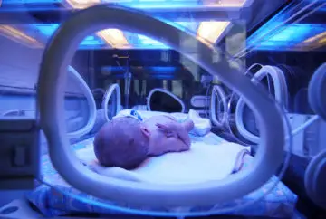 Premature baby under UV light therapy.