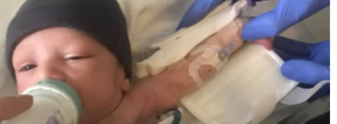 Newborn baby feeding with IV line.