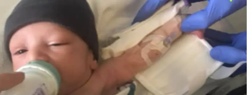 Newborn baby feeding with IV line.