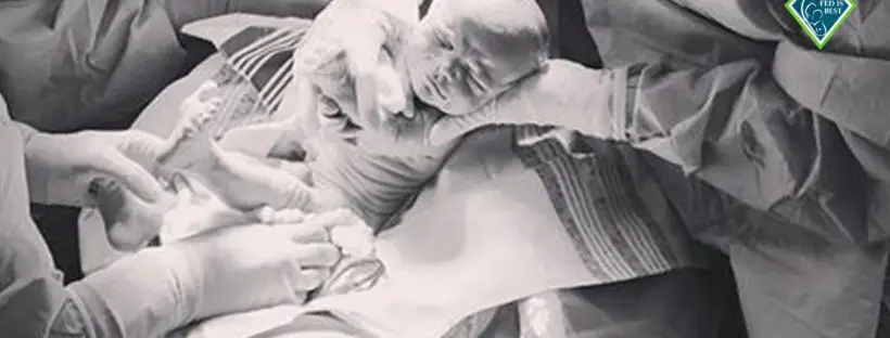 Newborn baby's birth in operating room.