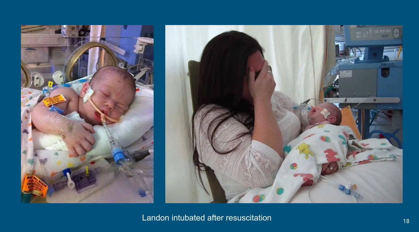 Baby in hospital with mother nearby. Baby in hospital with mother nearby.